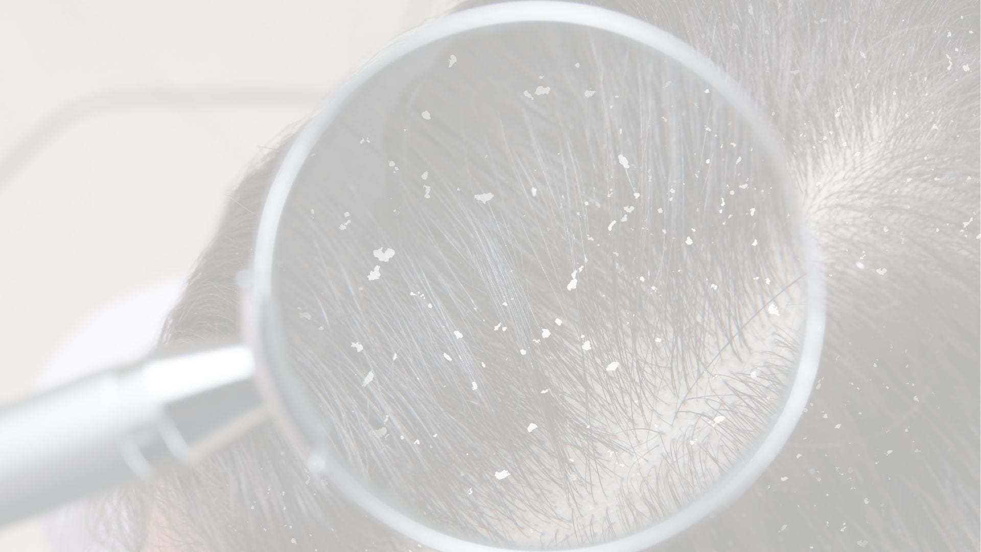Productos para Cuero Cabelludo con Caspa y Grasa